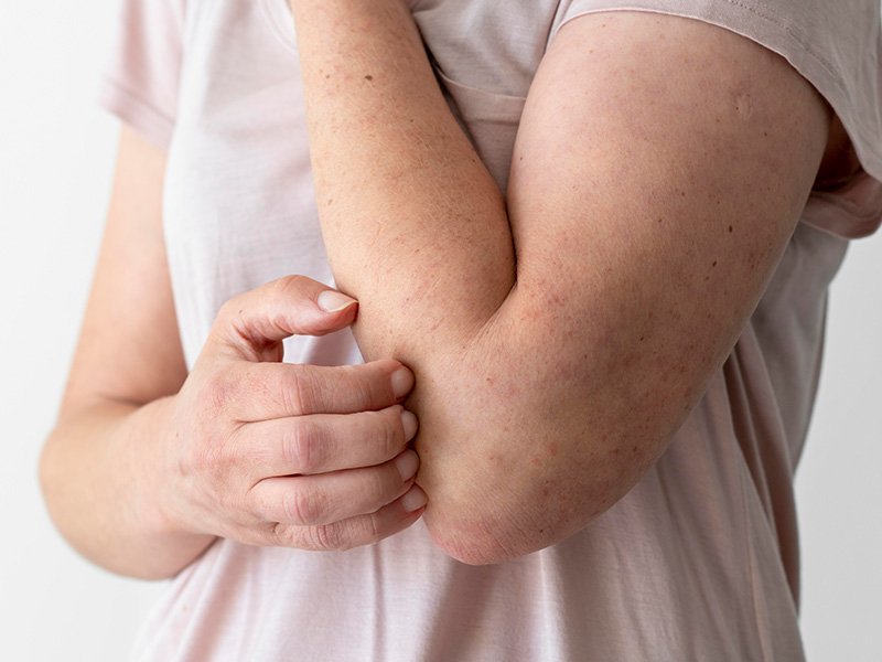 Treatment for pigmentation, skin infections, and problem skin