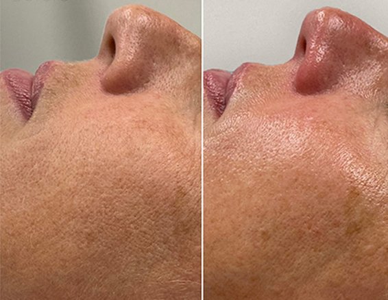 moisturize repair
