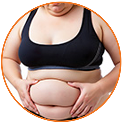 removing fat