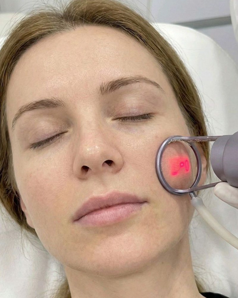 BA-FC26 treatment display-2
