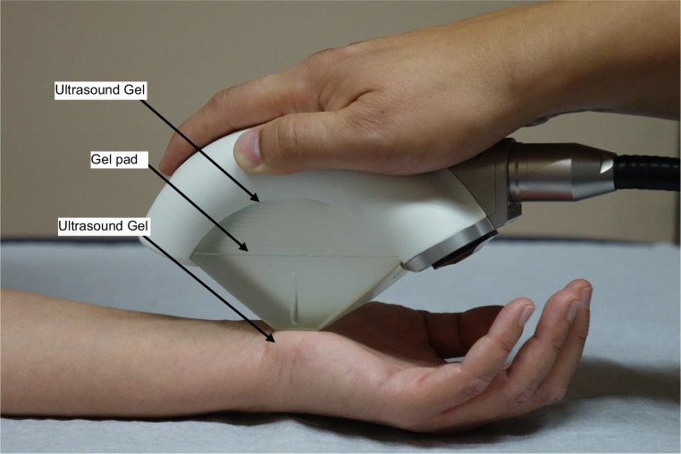 focused linear compression therapy
