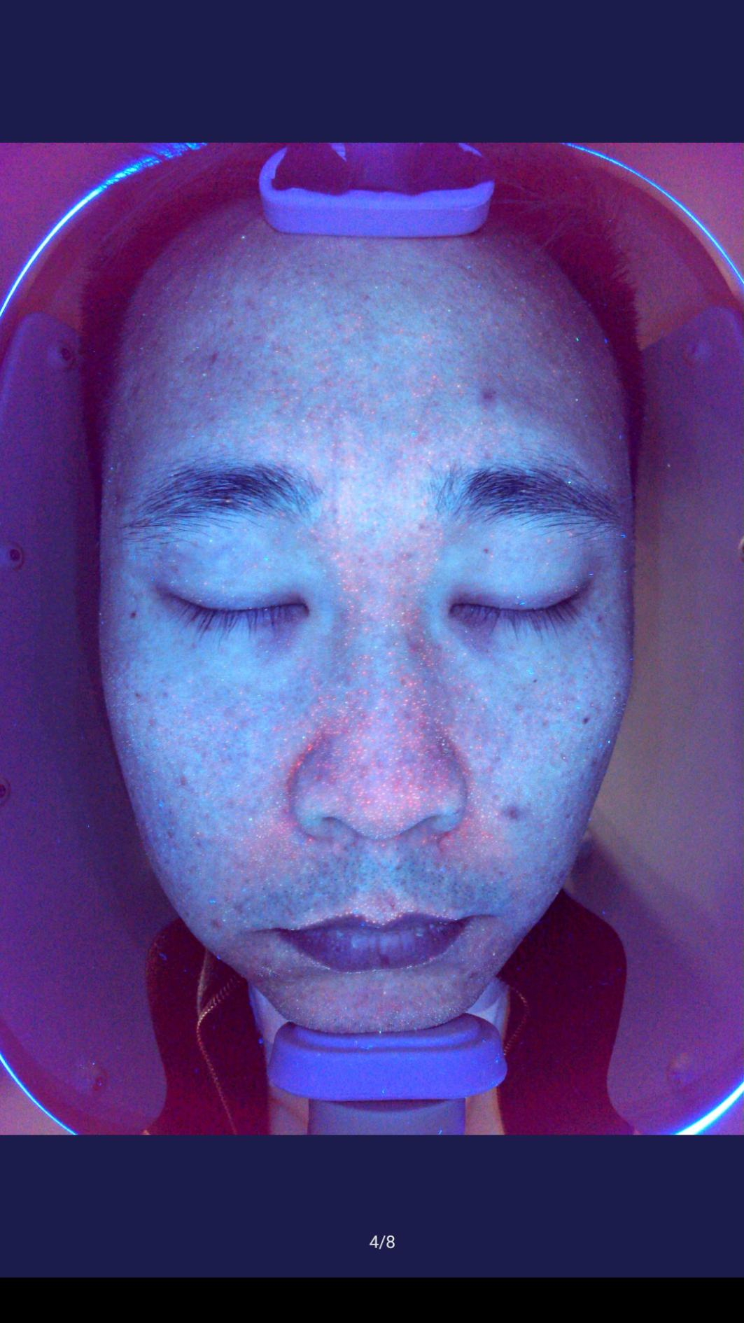 ba-an24 Uv light
