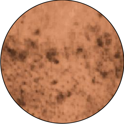 ba-an24-brown pigmentation