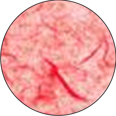 ba-an24-deep sensitivity