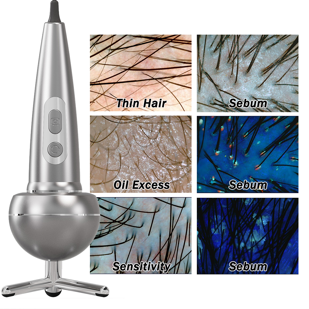 ba-an24 scalp detection handle