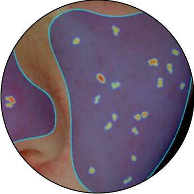 ba-an24-spot thermography