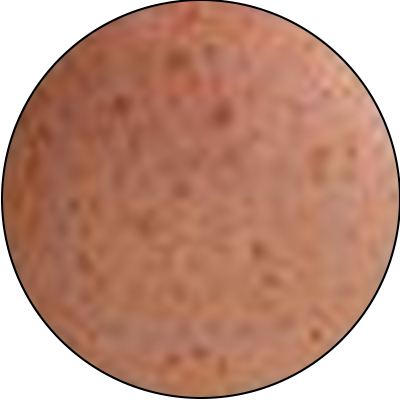 ba-an24-superficial pigmentation