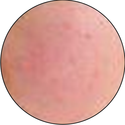 ba-an24-superficial sensitivity