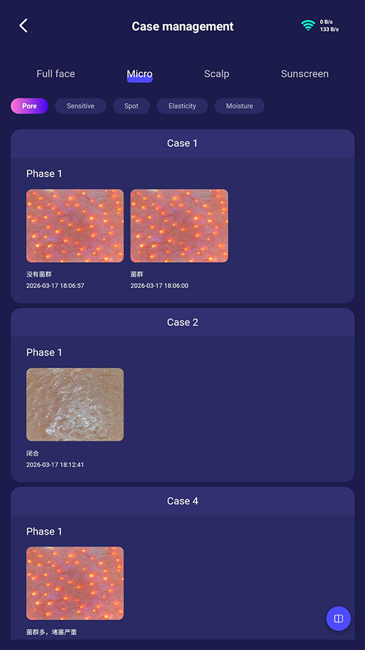 ba-an24 case mangement